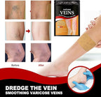 🔥 Varicose Veins Treatment Patch 🔥